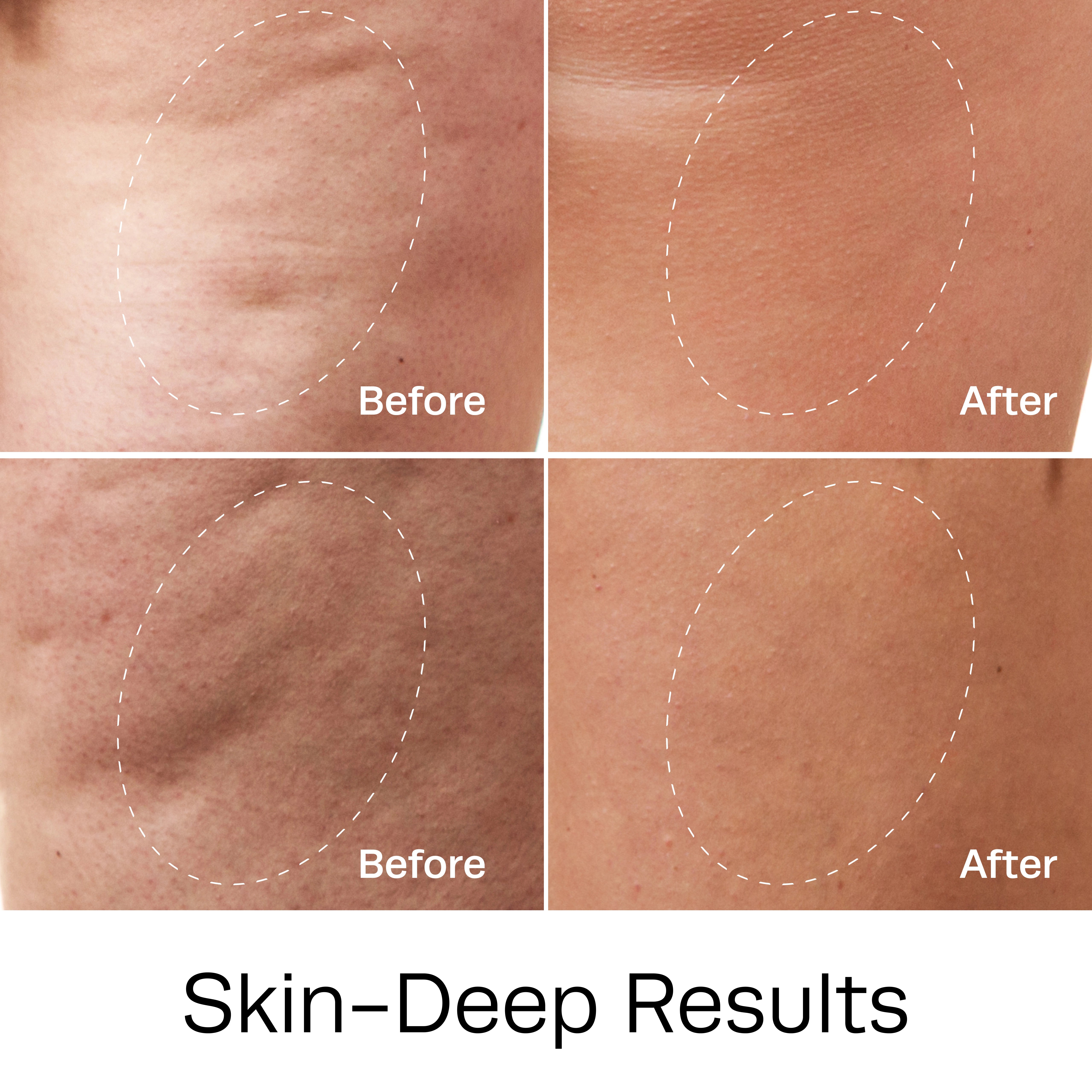 Smooth Gel